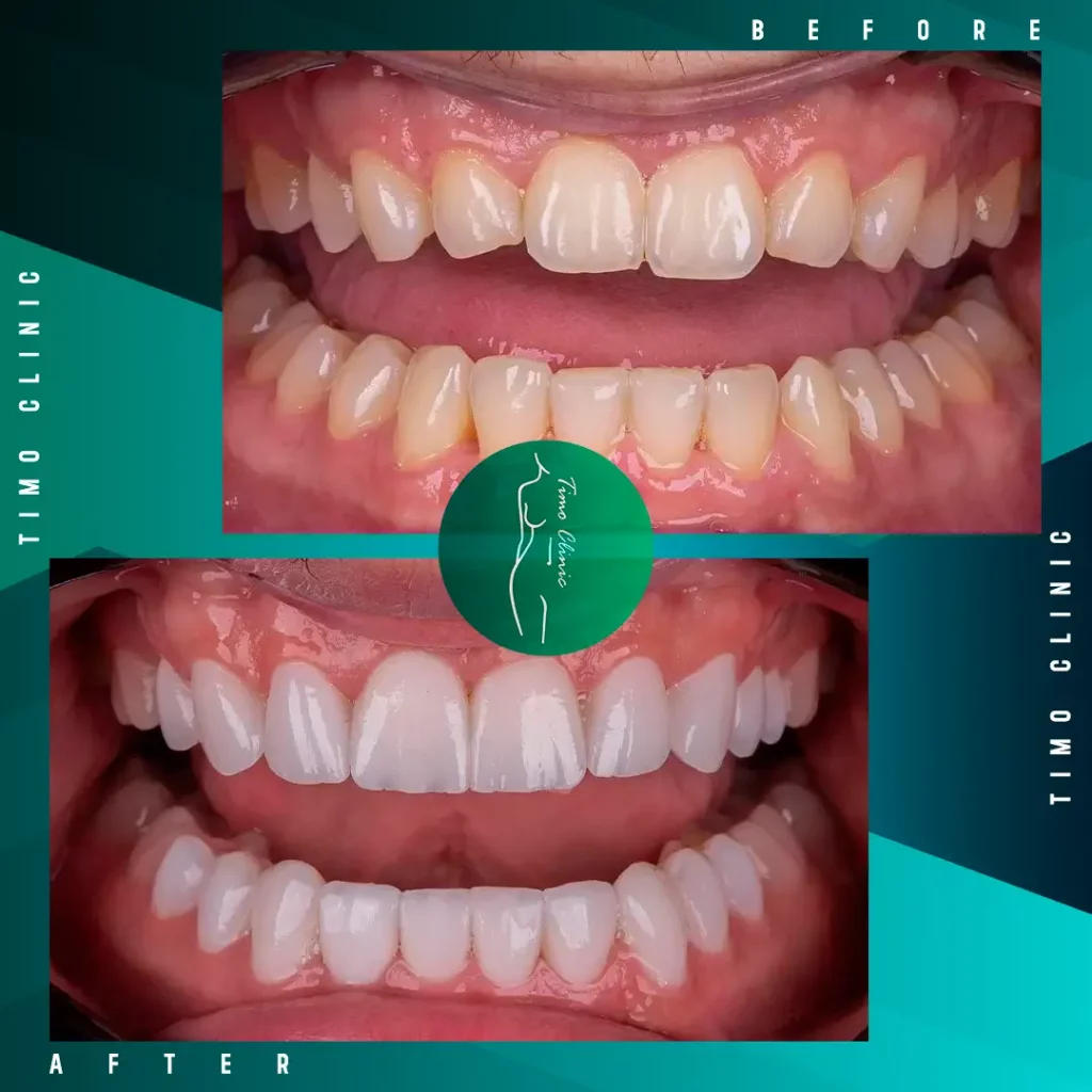 Design Before and After Timo Clinic design Green Dental 1