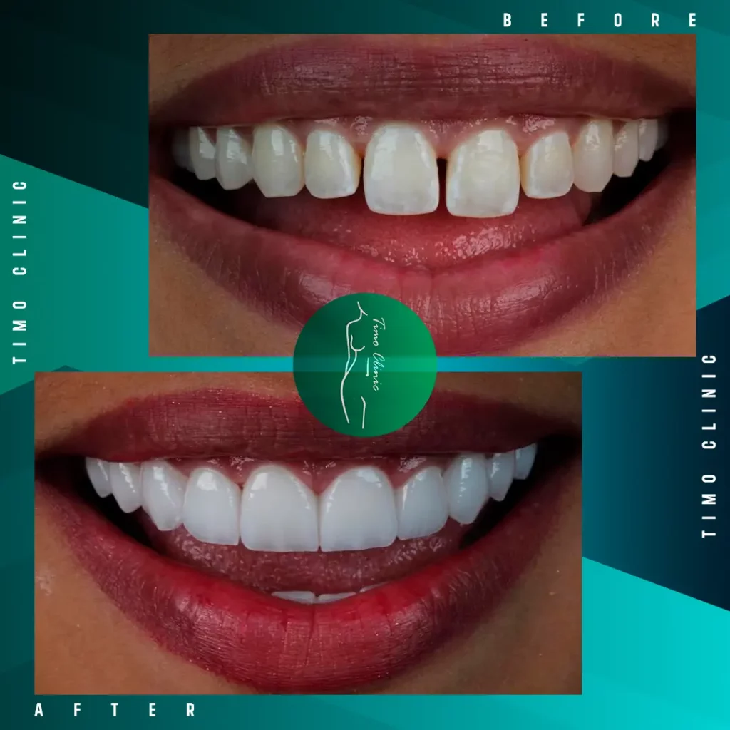 Design Before and After Timo Clinic design Green Dental 21