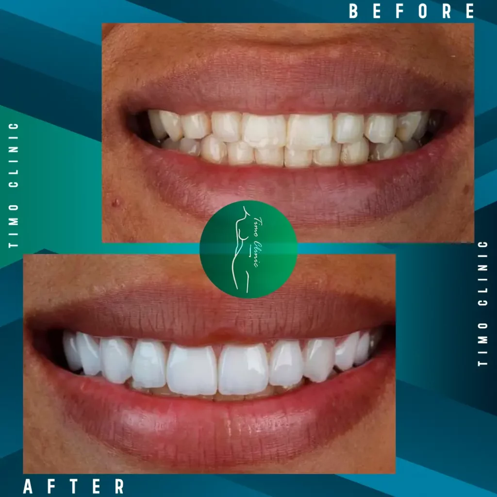 Design Before and After Timo Clinic design Green Dental 22