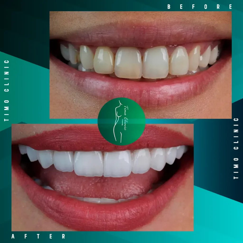 Design Before and After Timo Clinic design Green Dental 24