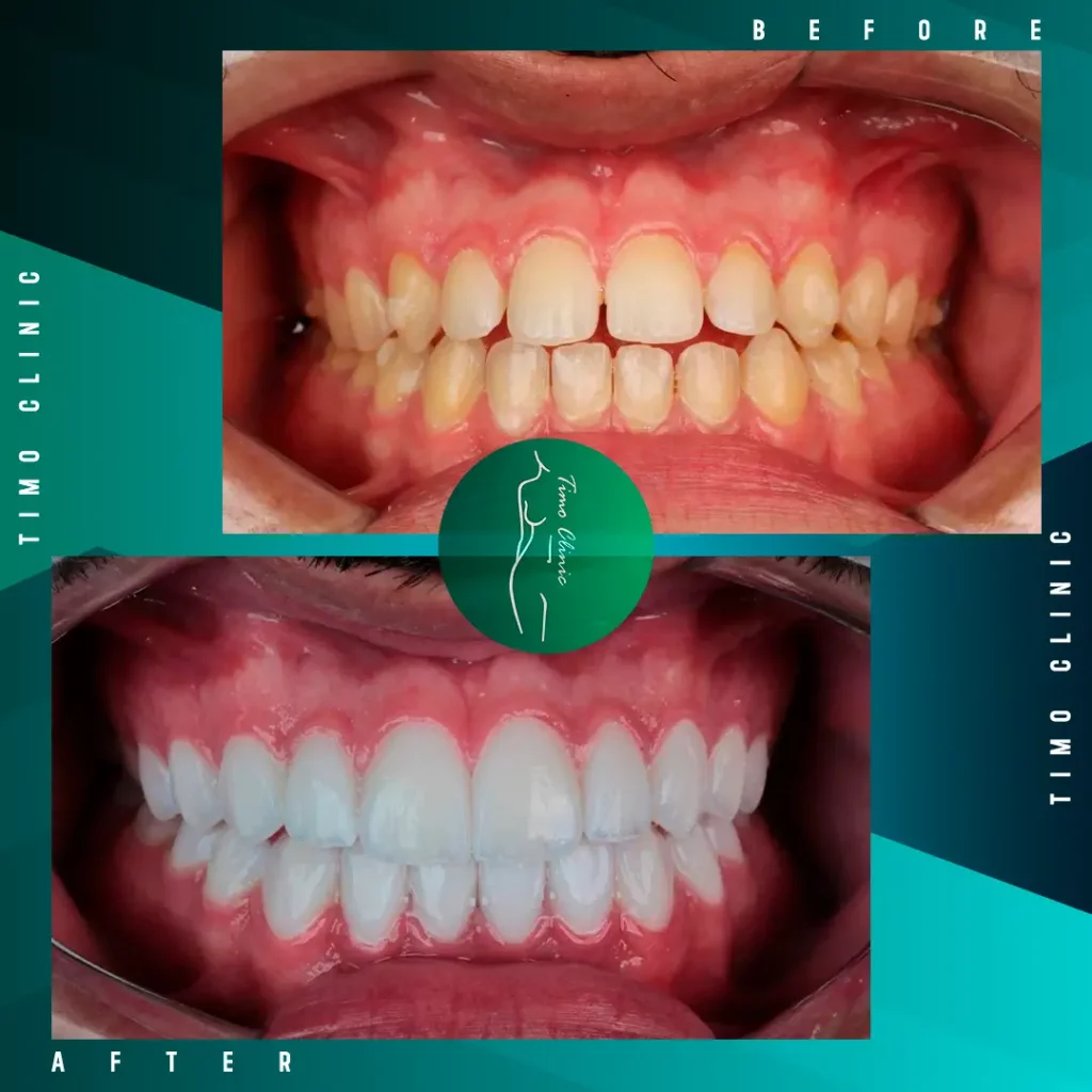 Design Before and After Timo Clinic design Green Dental 26