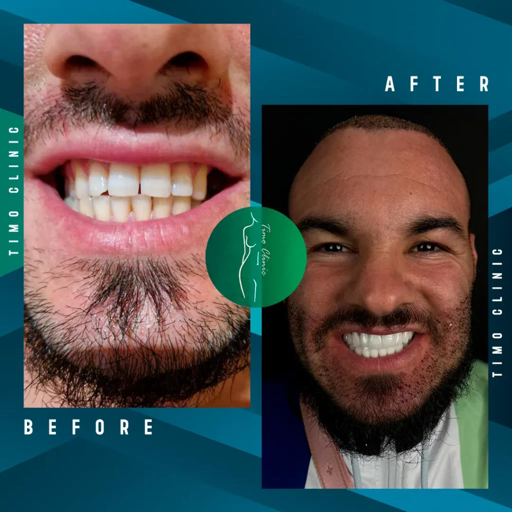 Design Before and After Timo Clinic design Green Dental 40
