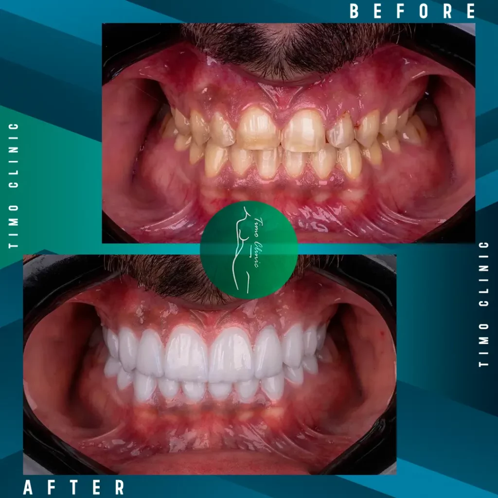 Design Before and After Timo Clinic design Green Dental 41