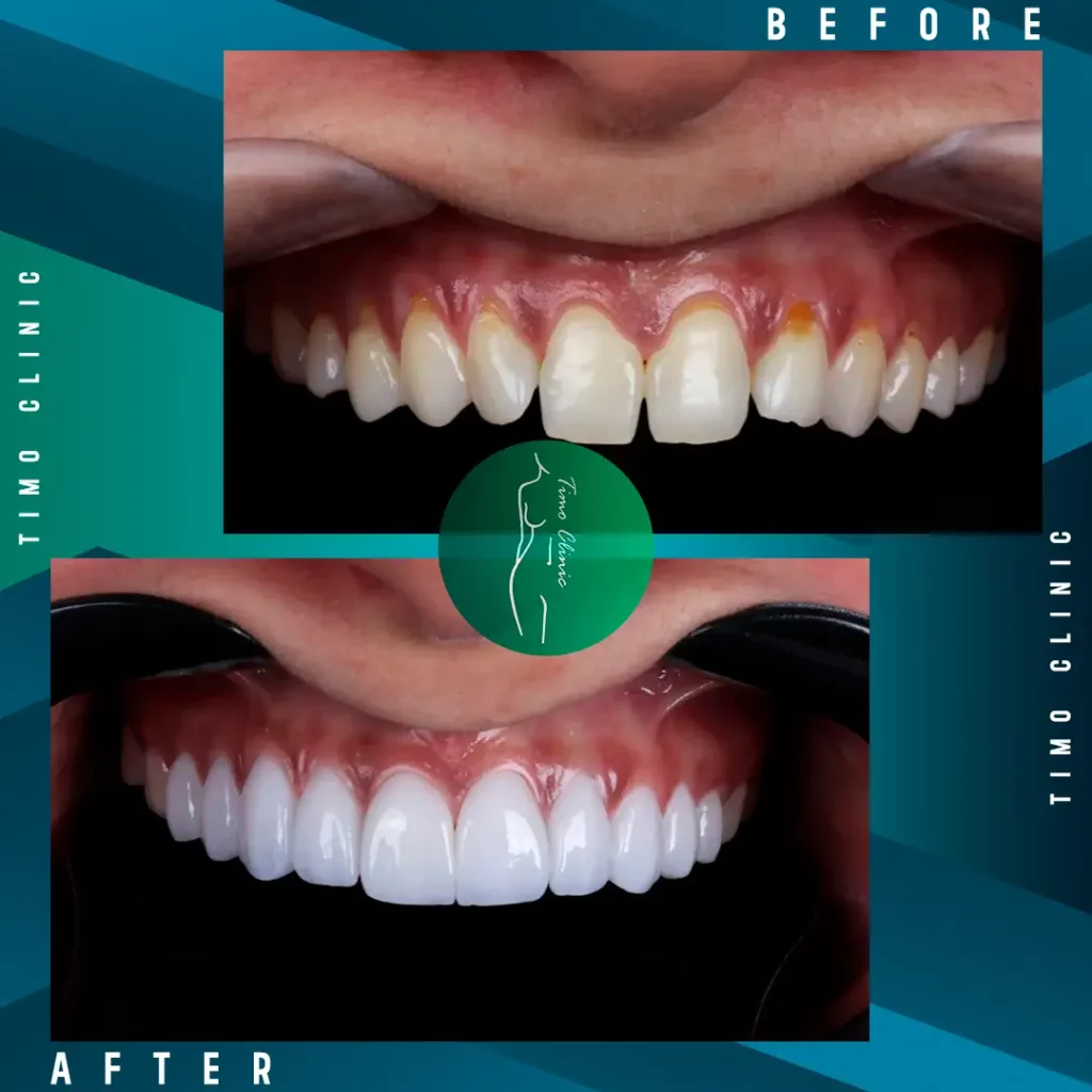 Design Before and After Timo Clinic design Green Dental 47