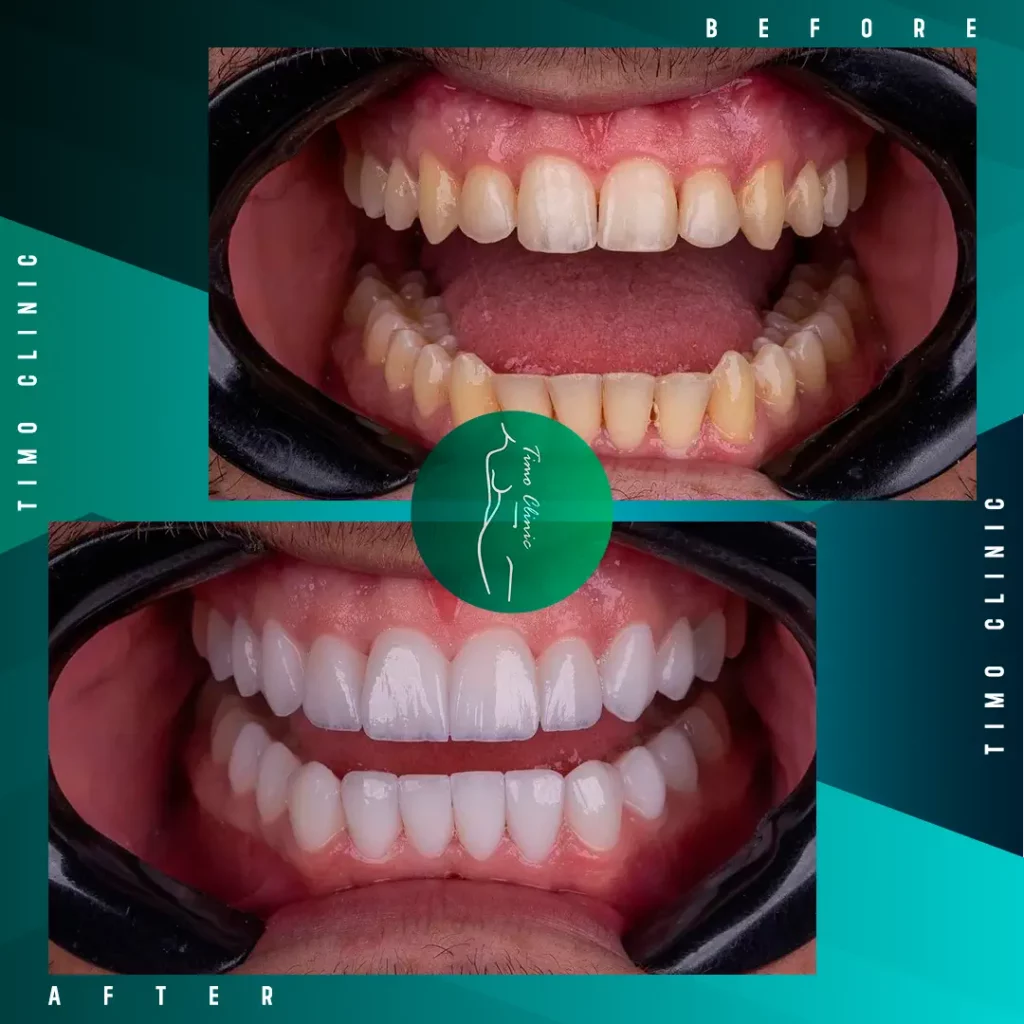 Design Before and After Timo Clinic design Green Dental 9