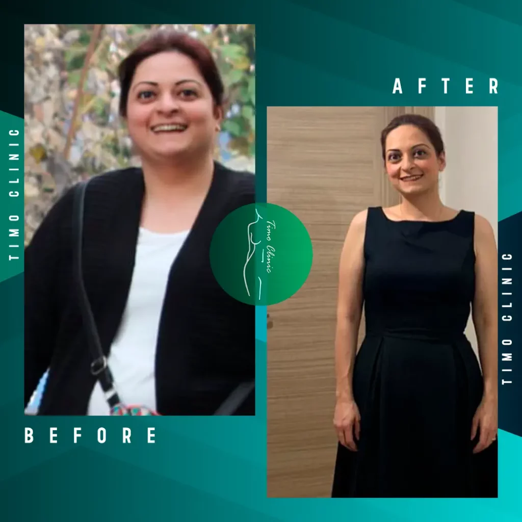 Design Before and After Timo Clinic Weight Loss 12