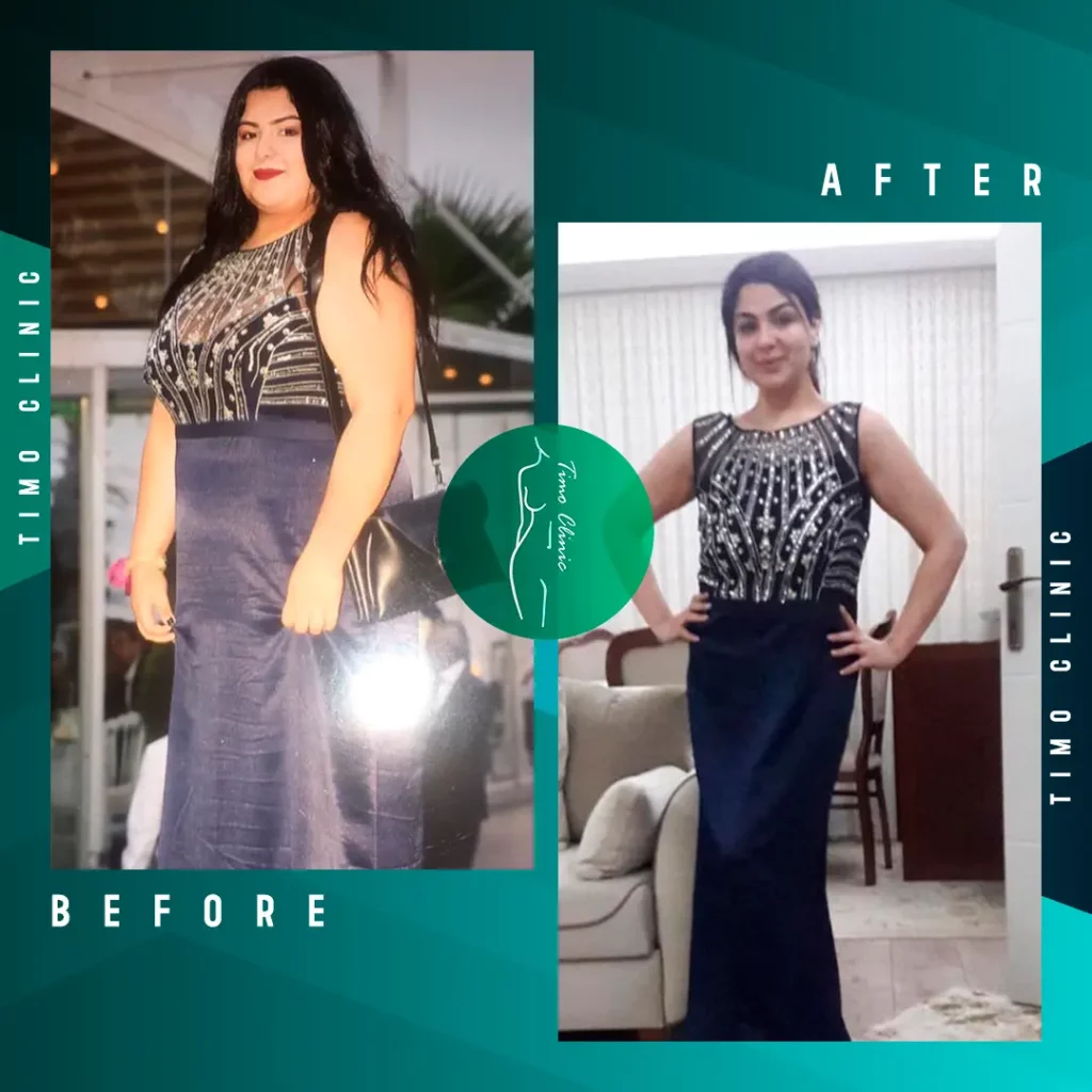 Design Before and After Timo Clinic Weight Loss 14