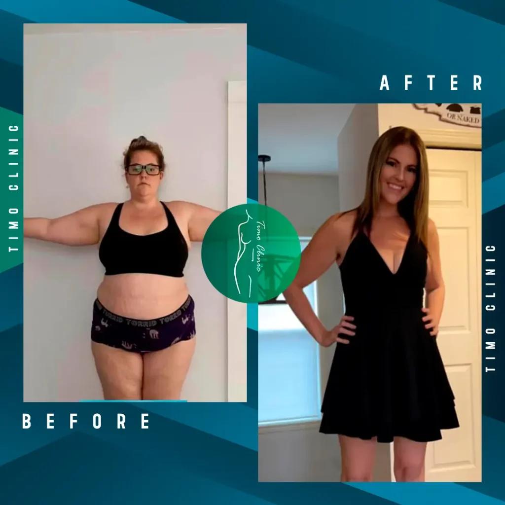 Design Before and After Timo Clinic Weight Loss 16