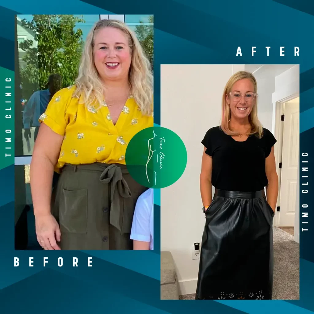 Design Before and After Timo Clinic Weight Loss 18