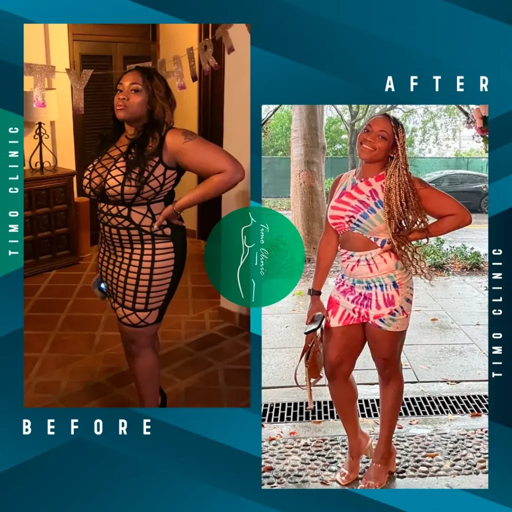 Design Before and After Timo Clinic Weight Loss 20