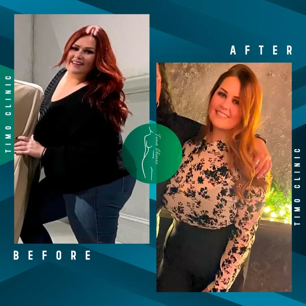 Design Before and After Timo Clinic Weight Loss 3