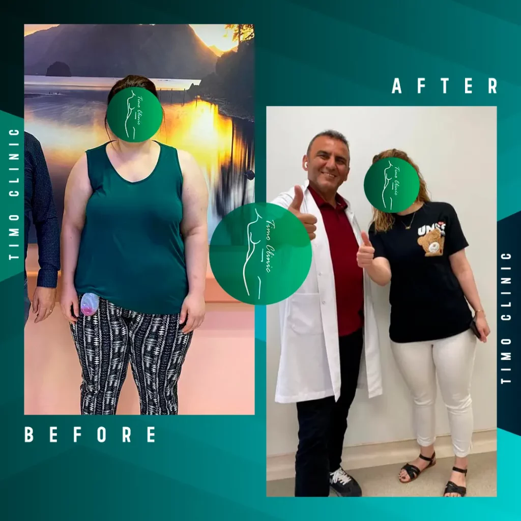 Design Before and After Timo Clinic Weight Loss 5