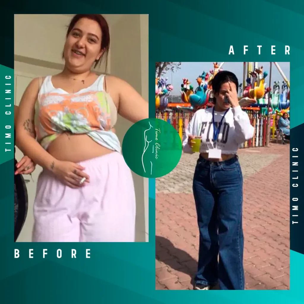 Design Before and After Timo Clinic Weight Loss 7