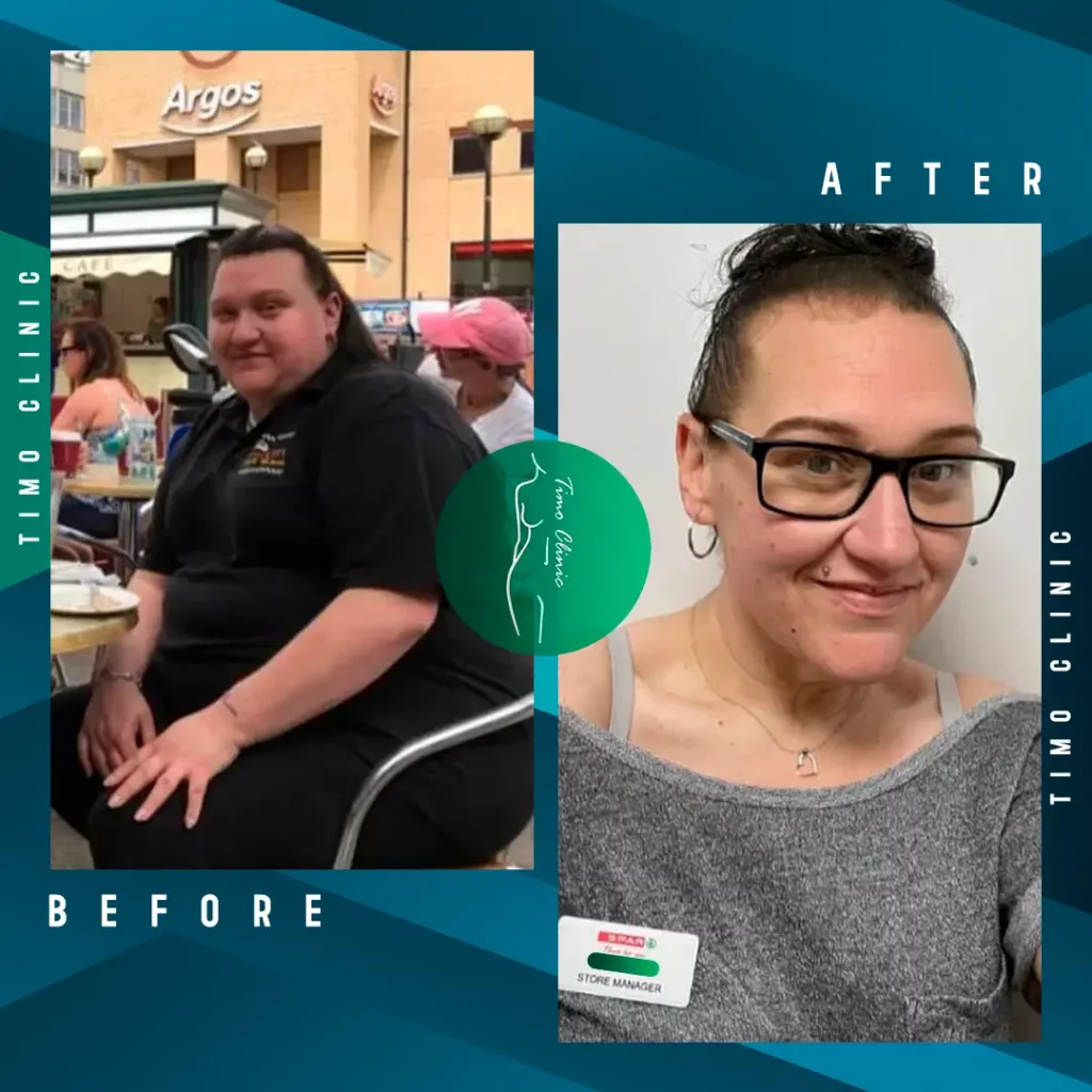 Design Before and After Timo Clinic Weight Loss 8